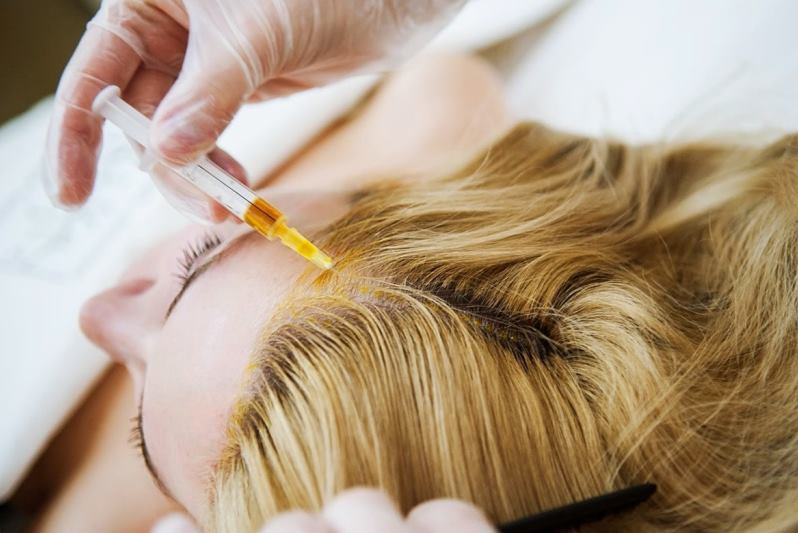 Плазмолифтинг волос