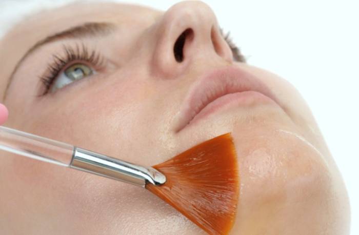 Процедура миндального пилинга