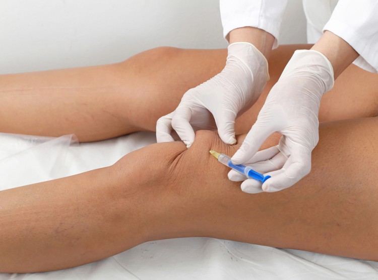 укол в колено