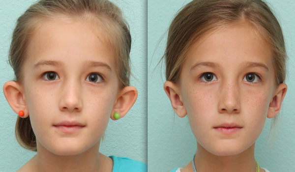 девушка с торчащими ушами и нет