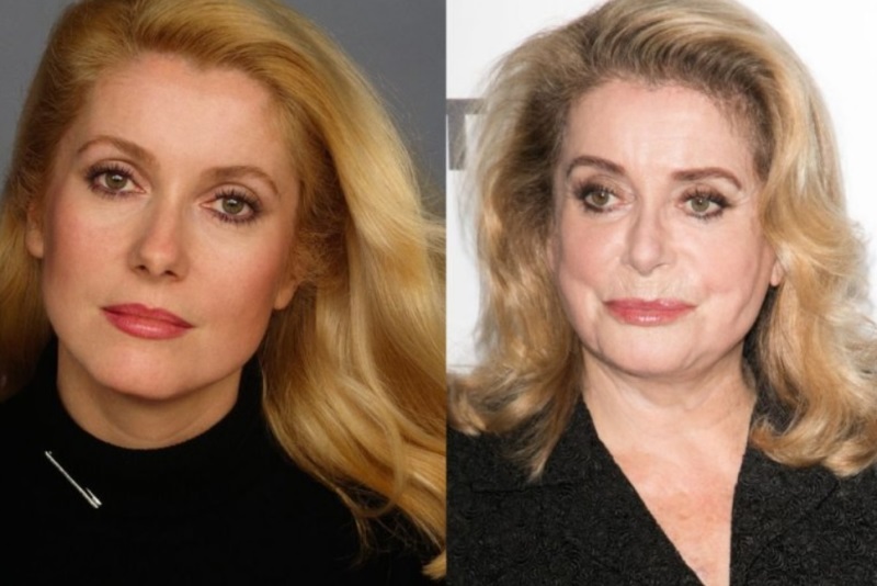 Деформационный тип старения кожи