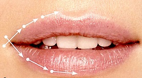 Линейная техника иглой увеличения губ