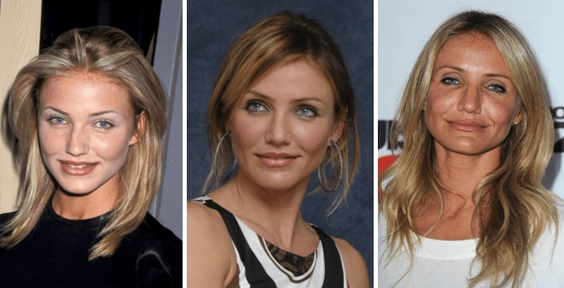 Мускульный тип старения кожи