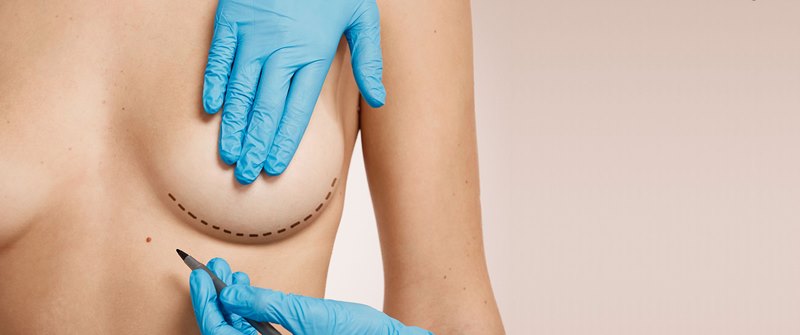 коррекция груди