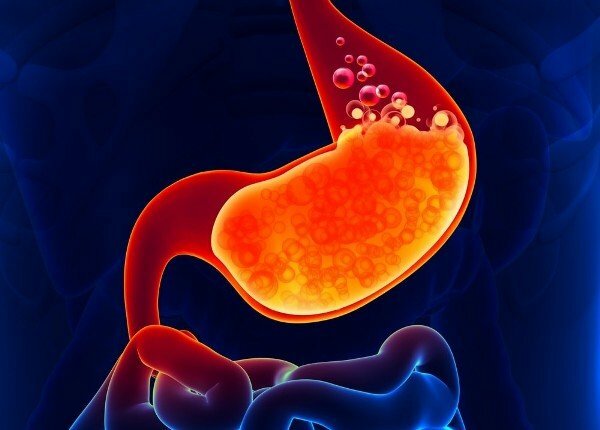 Изжога Изжога