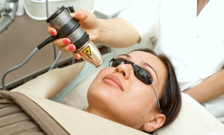 Лазерная шлифовка лица