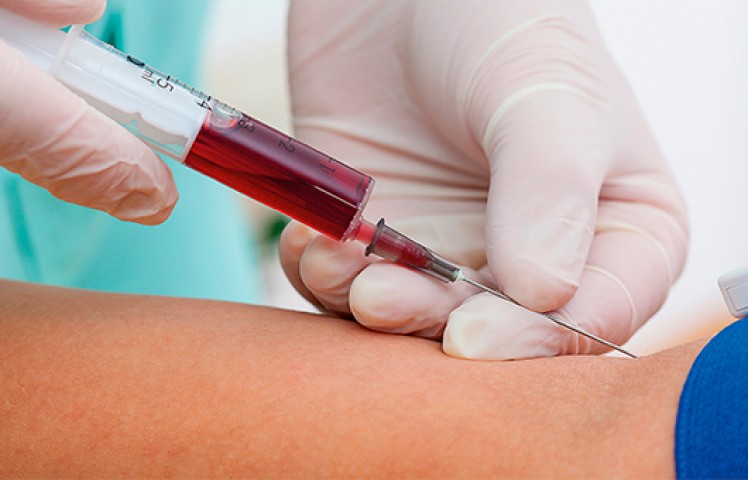 забор крови