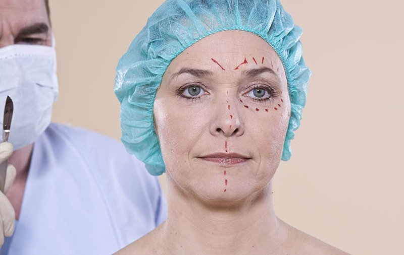 операция на лице