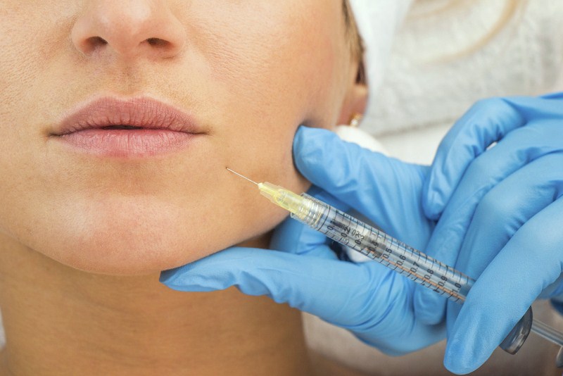 Мезотерапия