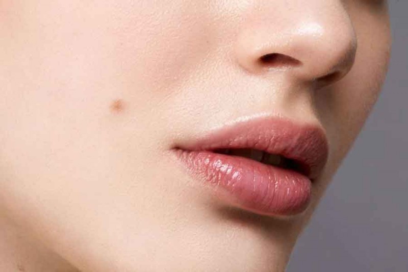 родинка на лице
