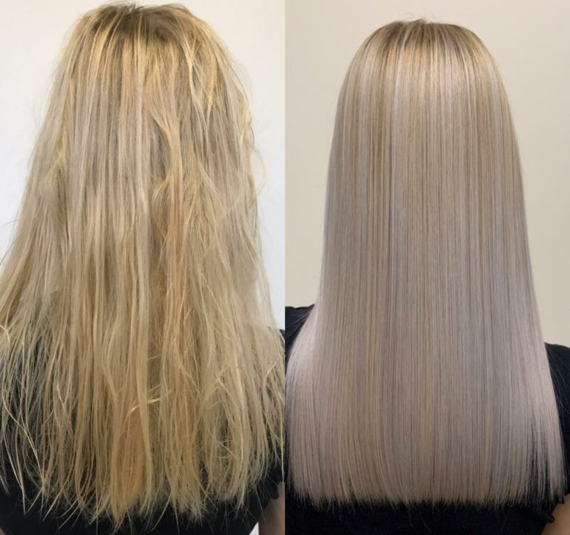 Ботокс в домашних условиях: фото до и после