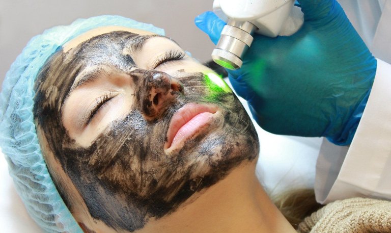 Косметолог проводит карбоновый пилинг