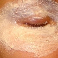 Гормональные прыщи у женщин лечение их медикаментозно и народными методами