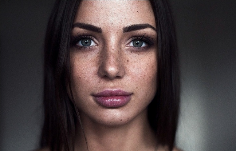 Пигментация на лице