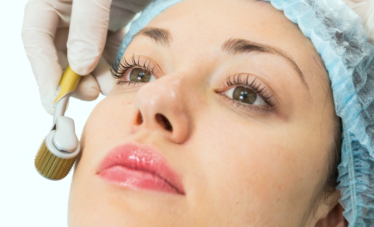 Использование мезороллера для лица