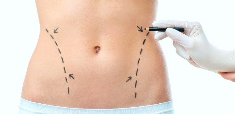 Как подтянуть кожу после похудения пластикой