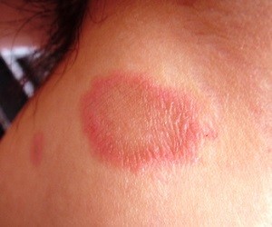 ???????????????????????????????