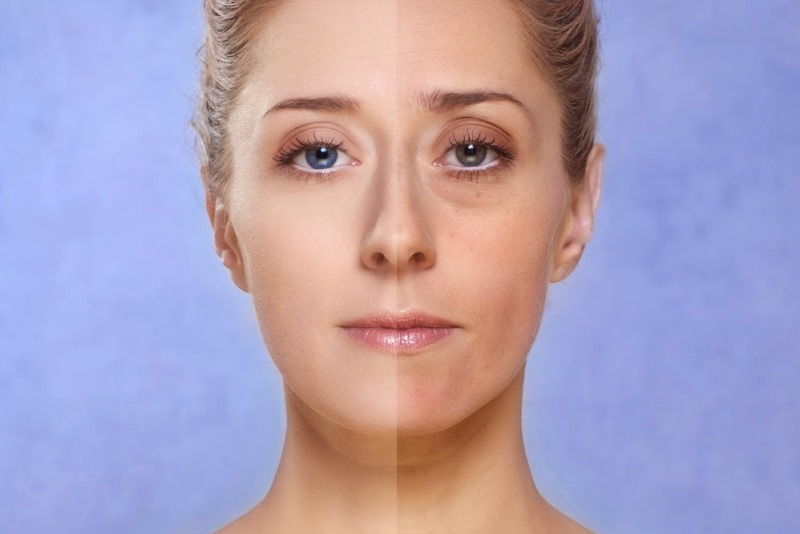 мешки под глазами: до и после