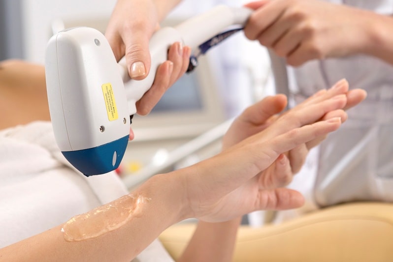 AFT эпиляция рук