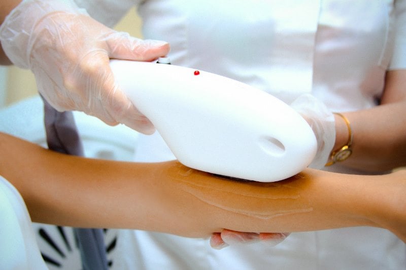 AFT эпиляция рук