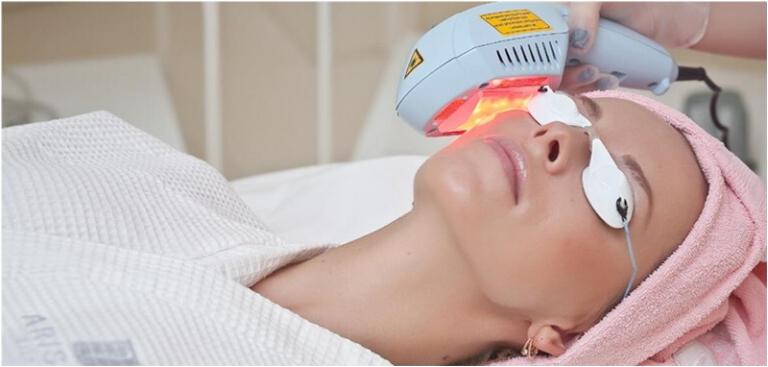 Лазерная безоперационная подтяжка лица