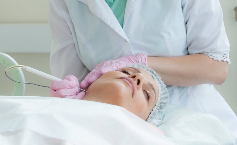 Удаление милиумов на лице