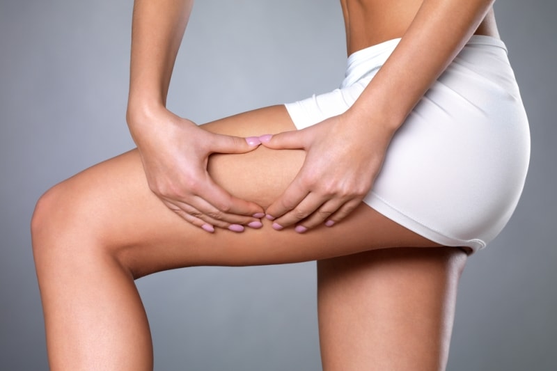 Целлюлит во время беременности