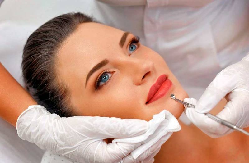 Лечение акне механическим путем