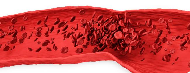 fibrinogen-v-krovi-norma