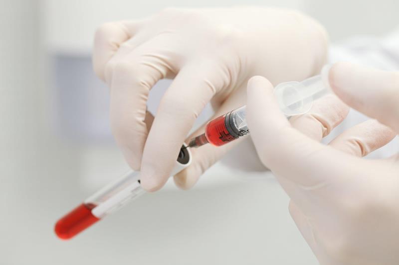 Укол с плазмой в руках врача