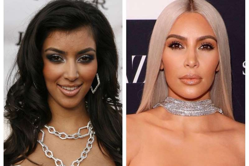 Ким Кардашьян до и после пластики