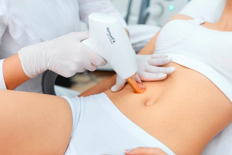 Удаление растяжек на коже