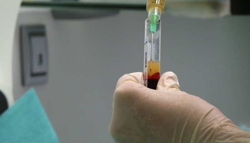 пробирка с плазмой для плазмолифтинга