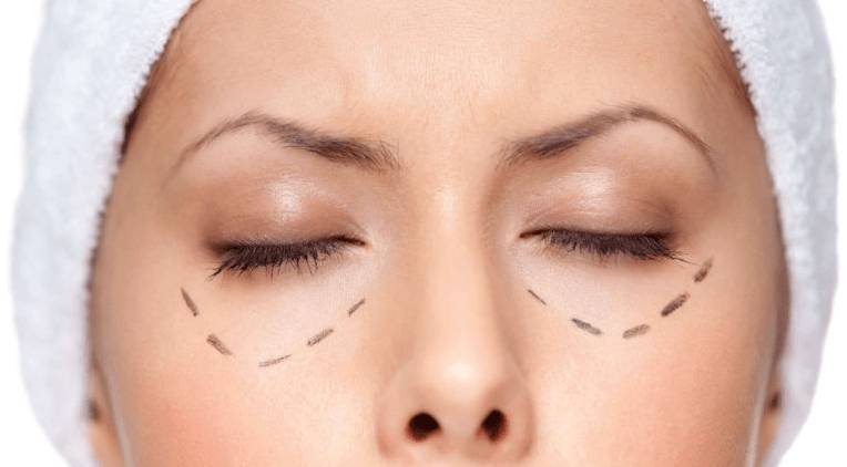 подготовка к пластике