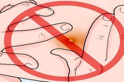 Как избавиться от привычки давить прыщи