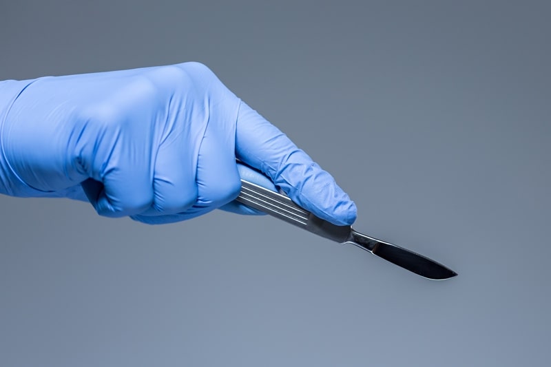 Скальпель в руках у хирурга