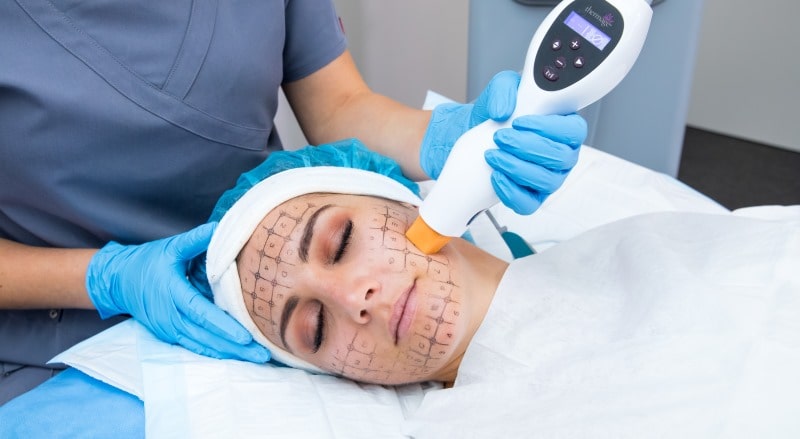 процедура аппаратного тармажа