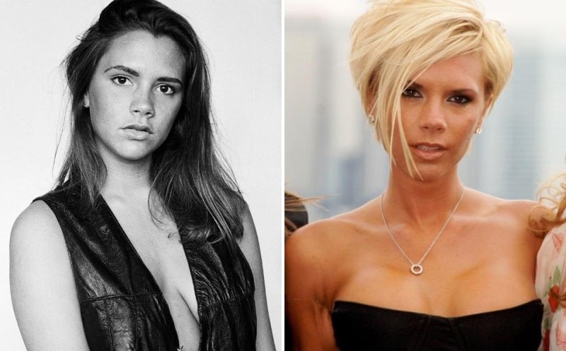 Виктория Бекхем до и после пластики