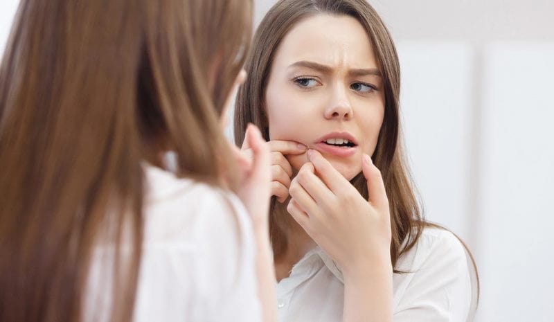 Девушка давит угри на лице