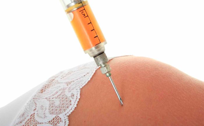 липофилинг ягодицы