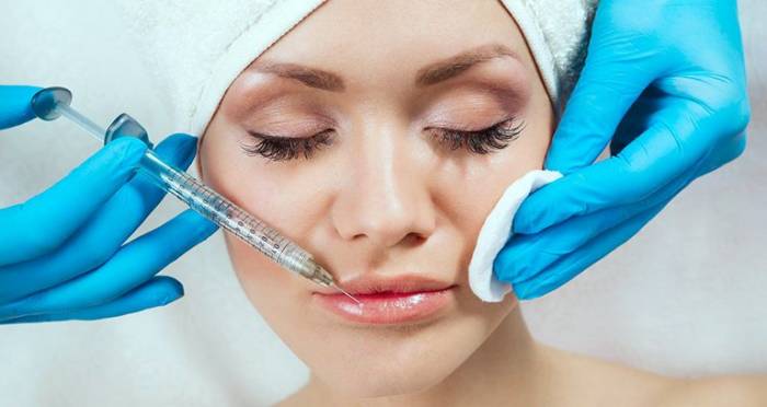 Увеличение губ филлером Принцесс