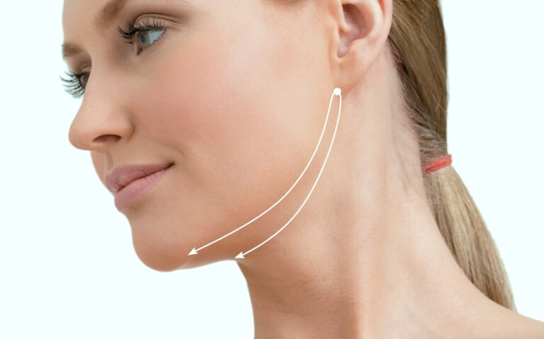 Стрелки возле шеи