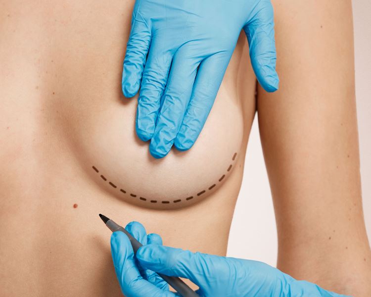 Пластика груди