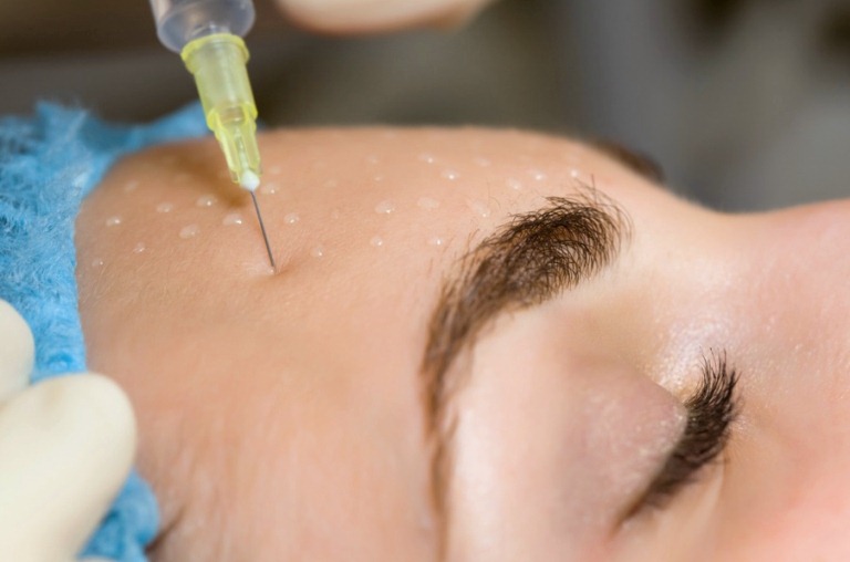 Проведение биоревитализации