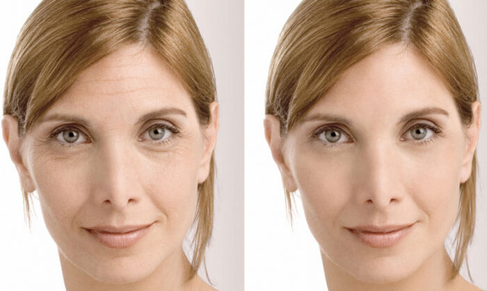 фото до и после