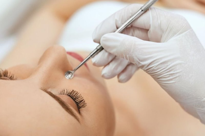 Чистка лица