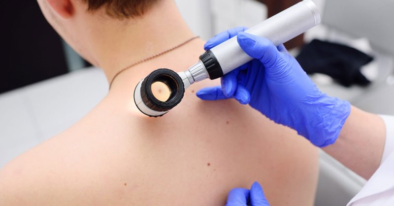 Проведение дерматоскопии