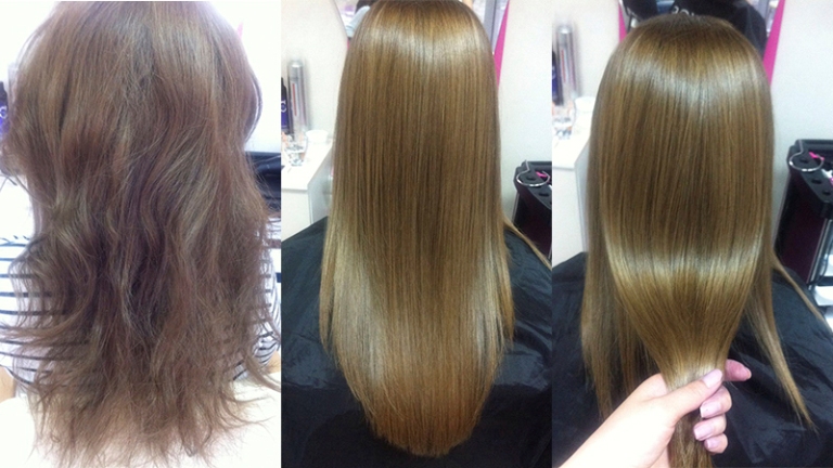 Honma Tokyo ботокс: до и после