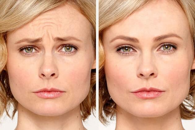 фото до и после блондинка