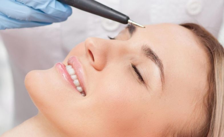 Электроэпиляция лица